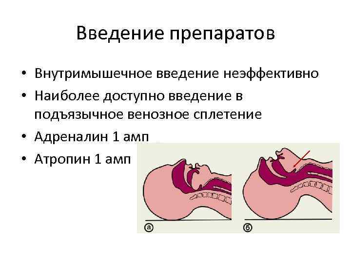 Введение препаратов • Внутримышечное введение неэффективно • Наиболее доступно введение в подъязычное венозное сплетение