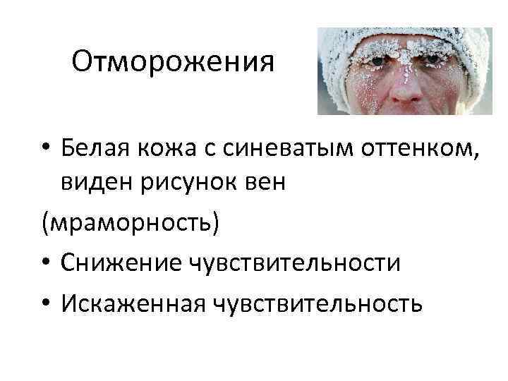 Отморожения • Белая кожа с синеватым оттенком, виден рисунок вен (мраморность) • Снижение чувствительности