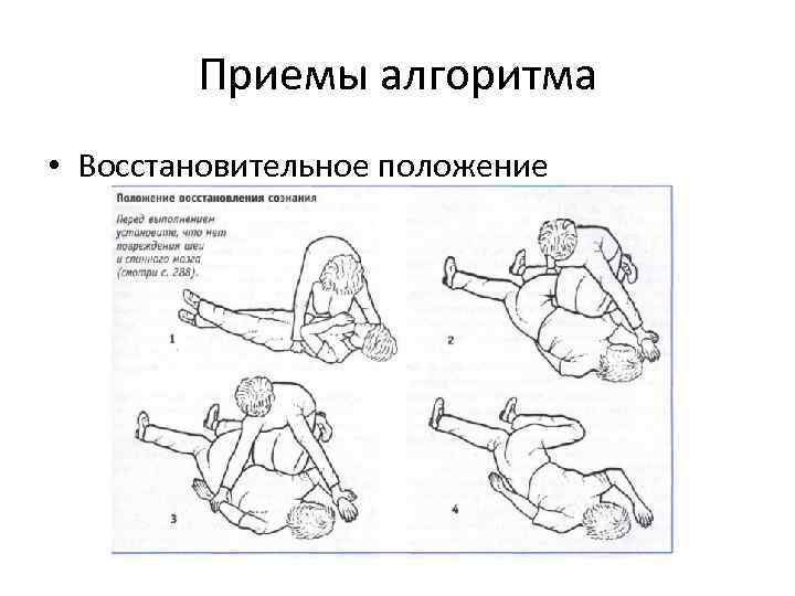 Приемы алгоритма • Восстановительное положение 