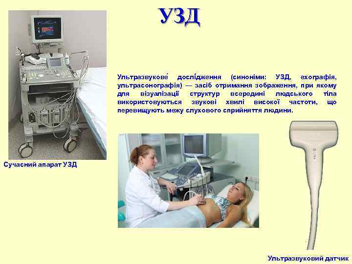 УЗД Ультразвукове дослі дження (синоніми: УЗД, ехографія, ультрасонографія) — засіб отримання зображення, при якому