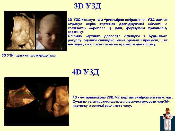 3 D УЗД показує нам тривимірне зображення. УЗД датчик отримує серію картинок досліджуваної області,