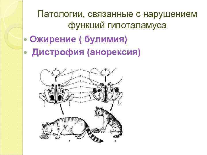 Патологии, связанные с нарушением функций гипоталамуса Ожирение ( булимия) Дистрофия (анорексия) 