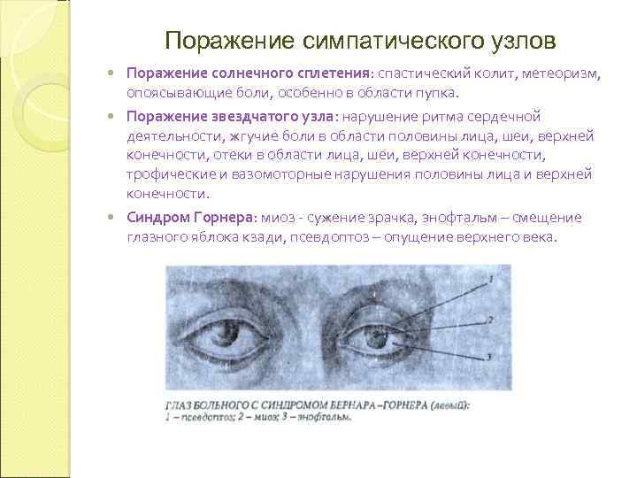 Поражение симпатического узлов Поражение солнечного сплетения: спастический колит, метеоризм, опоясывающие боли, особенно в области
