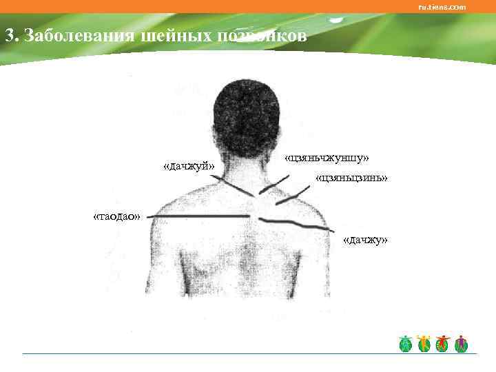 ru. tiens. com 3. Заболевания шейных позвонков «дачжуй» «цзяньчжуншу» «цзяньцзинь» «таодао» «дачжу» 