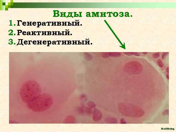 Виды амитоза. 1. Генеративный. 2. Реактивный. 3. Дегенеративный. Med. Biolog 