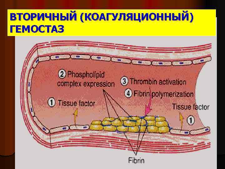 ВТОРИЧНЫЙ (КОАГУЛЯЦИОННЫЙ) ГЕМОСТАЗ 
