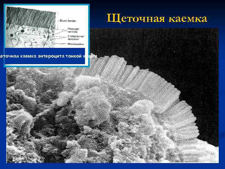 Щеточная каемка энтероцита тонкой кишки Щеточная каемка 