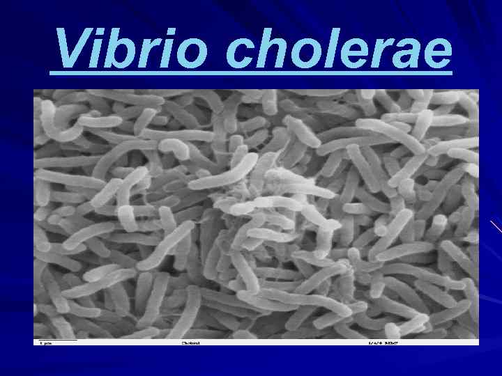 Vibrio cholerae 