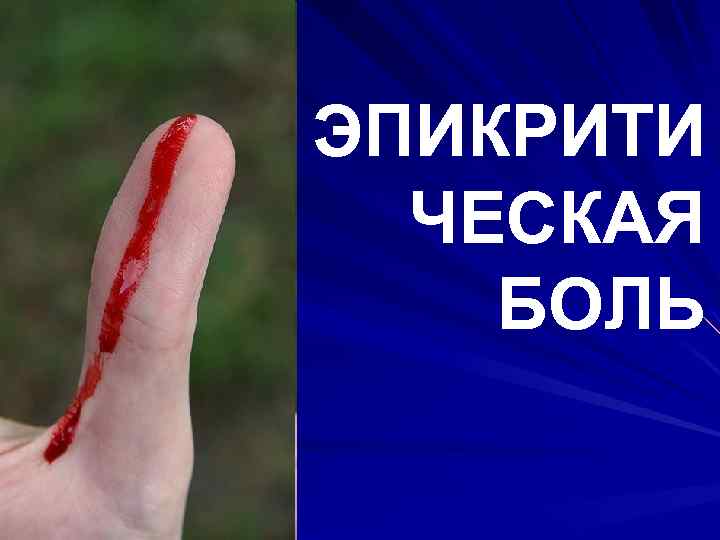 ЭПИКРИТИ ЧЕСКАЯ БОЛЬ 