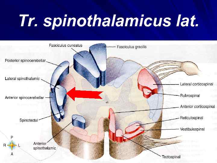 Tr. spinothalamicus lat. 