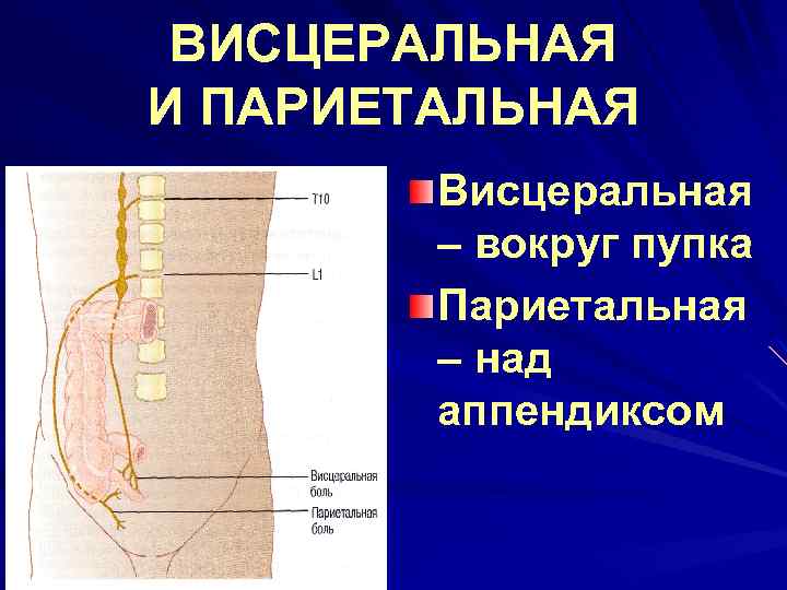 ВИСЦЕРАЛЬНАЯ И ПАРИЕТАЛЬНАЯ Висцеральная – вокруг пупка Париетальная – над аппендиксом 