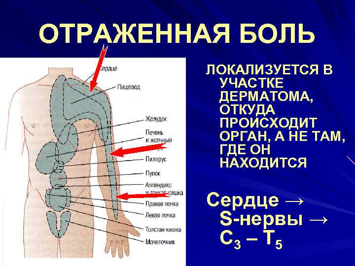 Проекция боли. Схема формирования отраженной боли. Механизм возникновения отраженной боли. Механизм формирования отраженной боли. Зоны отраженных болей.