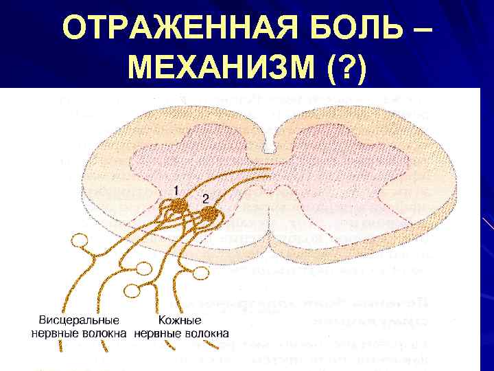 ОТРАЖЕННАЯ БОЛЬ – МЕХАНИЗМ (? ) 