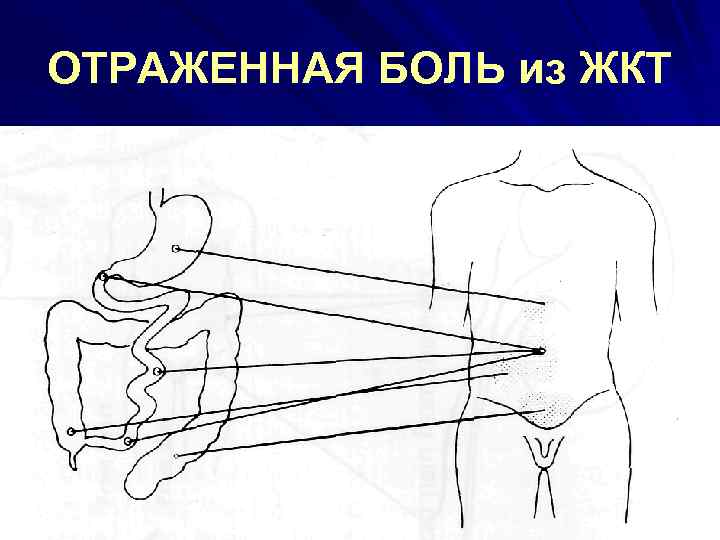 ОТРАЖЕННАЯ БОЛЬ из ЖКТ 
