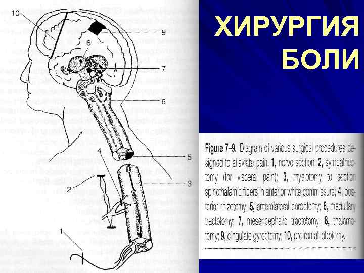 ХИРУРГИЯ БОЛИ 