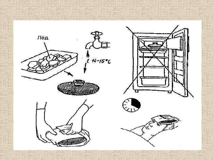 Пузырь со льдом. Схема постановки пузыря со льдом. Постановка пузыря со льдом алгоритм. Постановка пузыря со льдом детям. Техника постановки грелки, пузыря со льдом, горчичников.