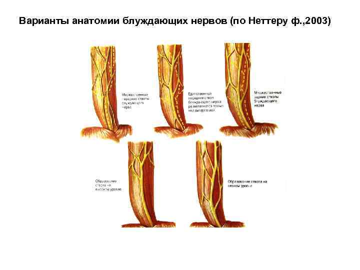 Варианты анатомии блуждающих нервов (по Неттеру ф. , 2003) 