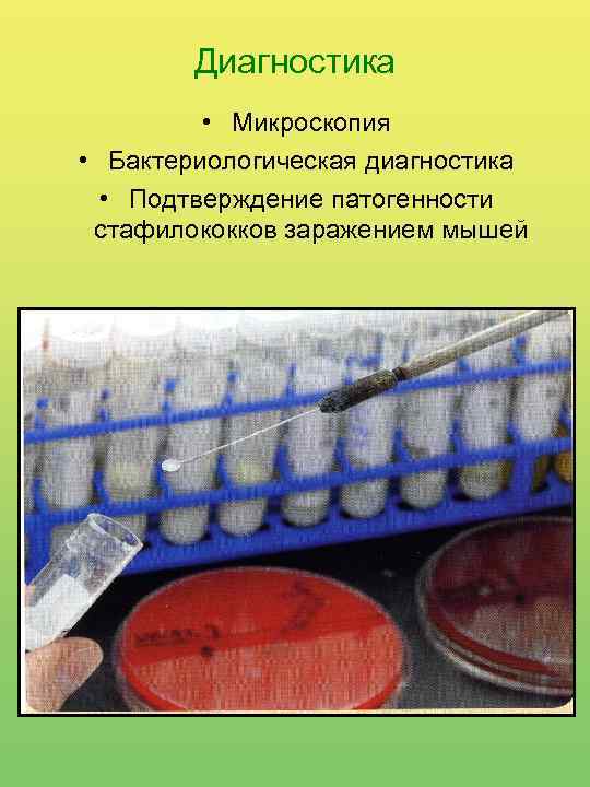 Диагностика • Микроскопия • Бактериологическая диагностика • Подтверждение патогенности стафилококков заражением мышей 