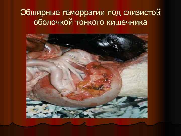 Обширные геморрагии под слизистой оболочкой тонкого кишечника 
