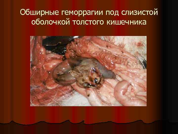 Обширные геморрагии под слизистой оболочкой толстого кишечника 
