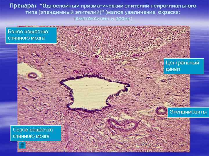Препарат "Однослойный призматический эпителий нейроглиального типа (эпендимный эпителий)" (малое увеличение, окраска: гематоксилин и эозин)