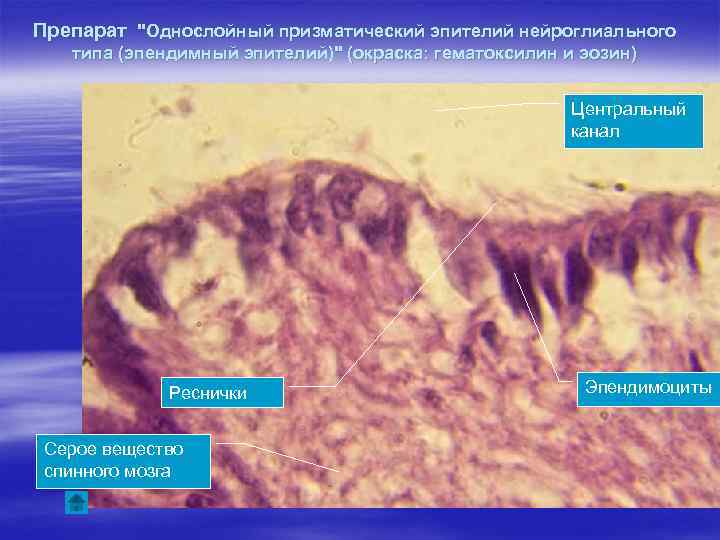 Препарат "Однослойный призматический эпителий нейроглиального типа (эпендимный эпителий)" (окраска: гематоксилин и эозин) Центральный канал