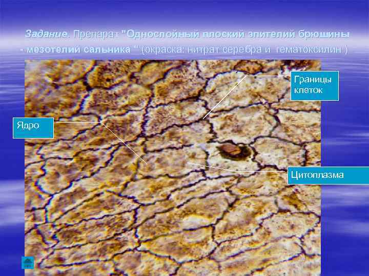 Задание. Препарат "Однослойный плоский эпителий брюшины - мезотелий сальника " (окраска: нитрат серебра и