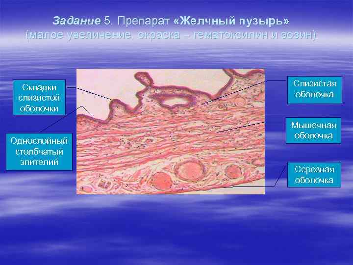 Задание 5. Препарат «Желчный пузырь» (малое увеличение, окраска – гематоксилин и эозин) Складки слизистой