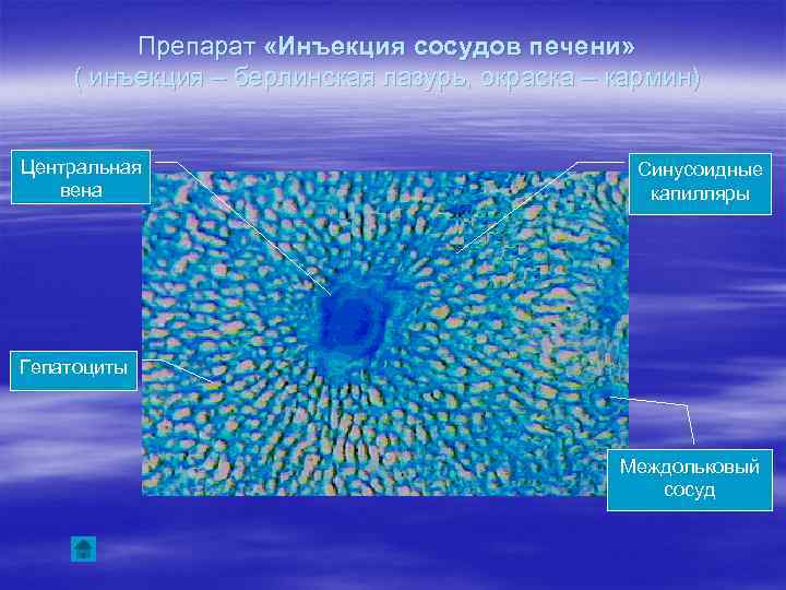Препарат «Инъекция сосудов печени» ( инъекция – берлинская лазурь, окраска – кармин) Центральная вена