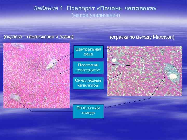 Задание 1. Препарат «Печень человека» (малое увеличение) (окраска – гематокслин и эозин) (окраска по