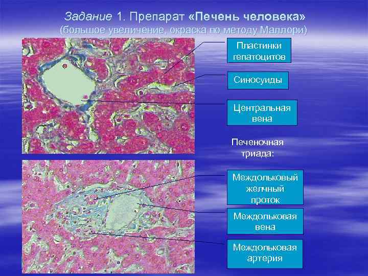 Печень гистология