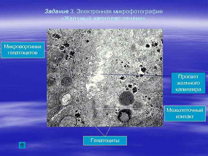 Задание 3. Электронная микрофотография «Желчный капилляр печени» Микроворсинки гепатоцитов Просвет желчного капилляра Межклеточный контакт