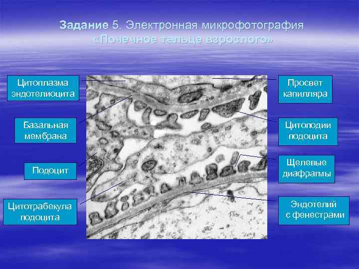 Задание 5. Электронная микрофотография «Почечное тельце взрослого» Цитоплазма эндотелиоцита Просвет капилляра Базальная мембрана Цитоподии