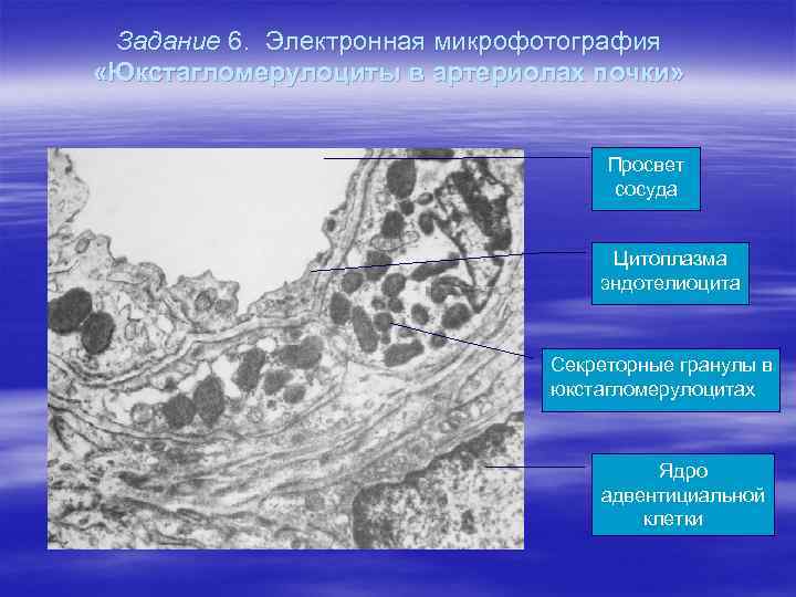 Задание 6. Электронная микрофотография «Юкстагломерулоциты в артериолах почки» Просвет сосуда Цитоплазма эндотелиоцита Секреторные гранулы