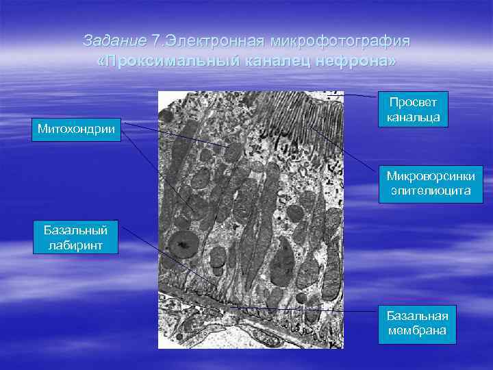 Задание 7. Электронная микрофотография «Проксимальный каналец нефрона» Митохондрии Просвет канальца Микроворсинки эпителиоцита Базальный лабиринт