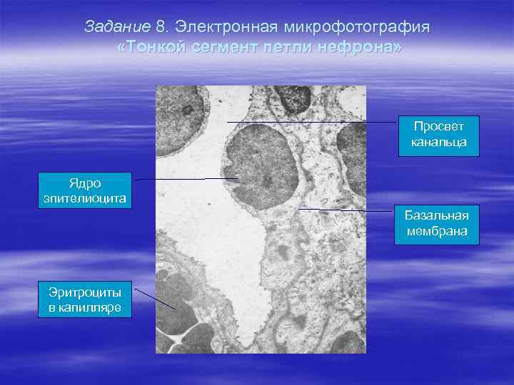 Задание 8. Электронная микрофотография «Тонкой сегмент петли нефрона» Просвет канальца Ядро эпителиоцита Базальная мембрана