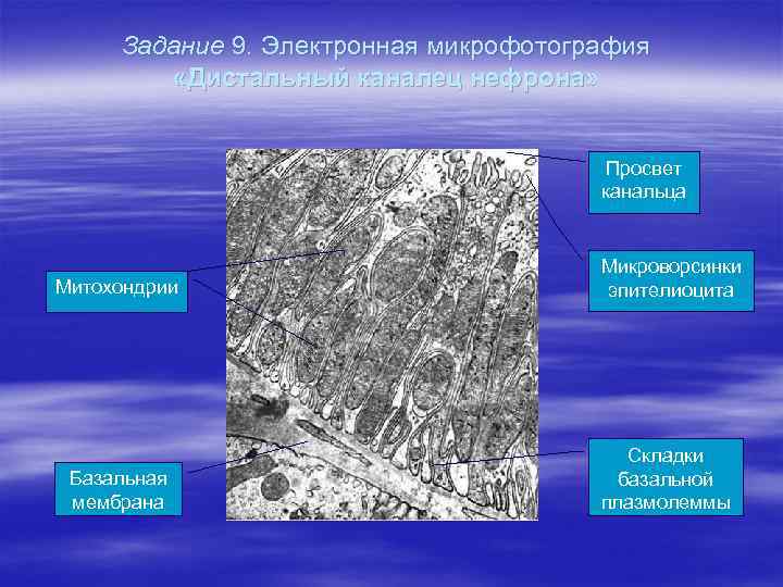 Задание 9. Электронная микрофотография «Дистальный каналец нефрона» Просвет канальца Митохондрии Микроворсинки эпителиоцита Базальная мембрана