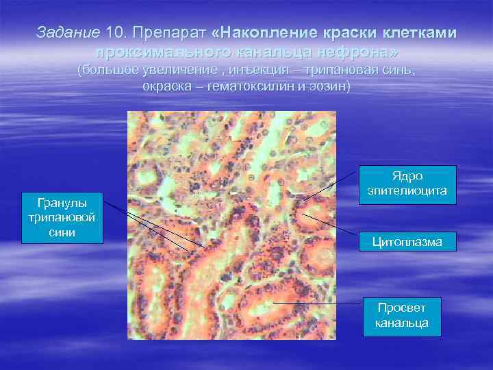 Задание 10. Препарат «Накопление краски клетками проксимального канальца нефрона» (большое увеличение , инъекция –