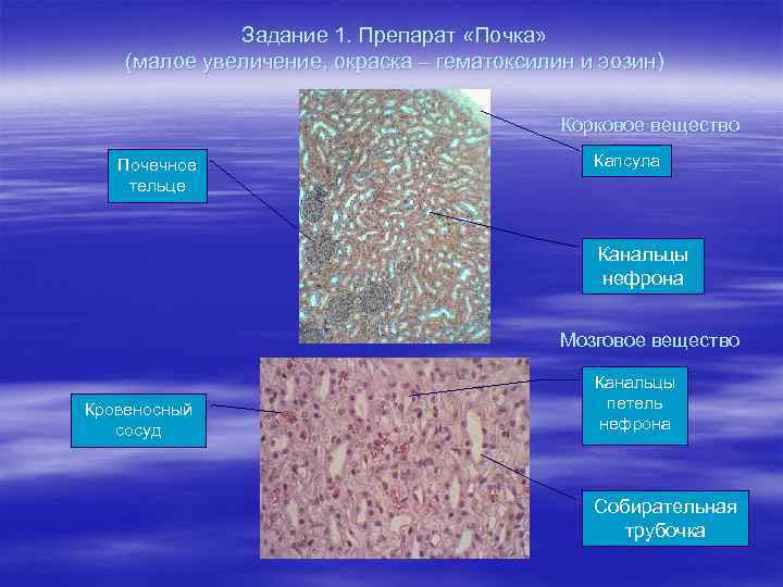 Задание 1. Препарат «Почка» (малое увеличение, окраска – гематоксилин и эозин) Корковое вещество Почечное