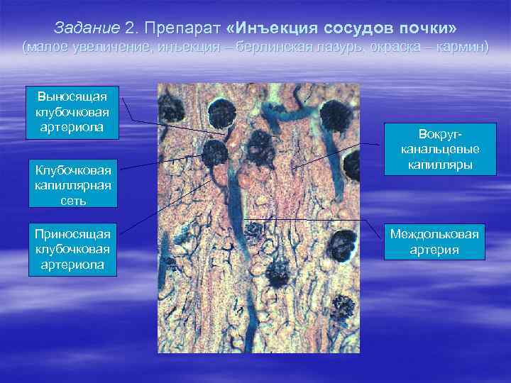 Задание 2. Препарат «Инъекция сосудов почки» (малое увеличение, инъекция – берлинская лазурь, окраска –
