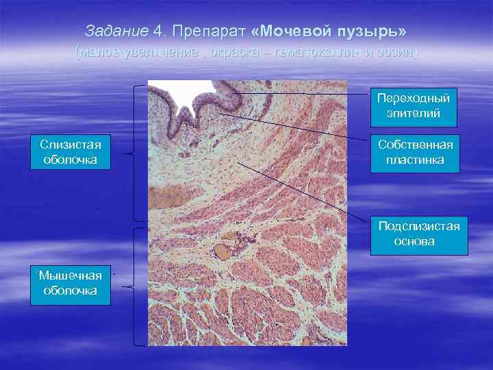 Стенка пузыря. Гистологический препарат мочевой пузырь. Мочевой пузырь гистология препарат. Строение мочевого пузыря гистология. Стенка мочевого пузыря гистология.
