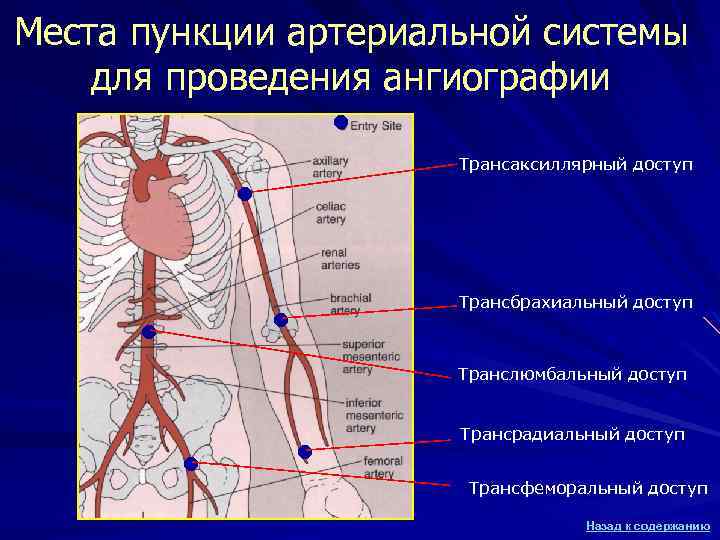 Места пункции артериальной системы для проведения ангиографии ● Трансаксиллярный доступ ● Трансбрахиальный доступ ●