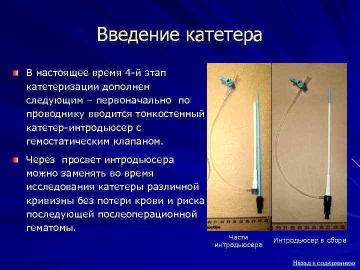 Введение катетера В настоящее время 4 -й этап катетеризации дополнен следующим – первоначально по