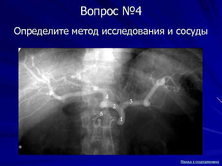 Вопрос № 4 Определите метод исследования и сосуды 4 3 2 5 1 Назад