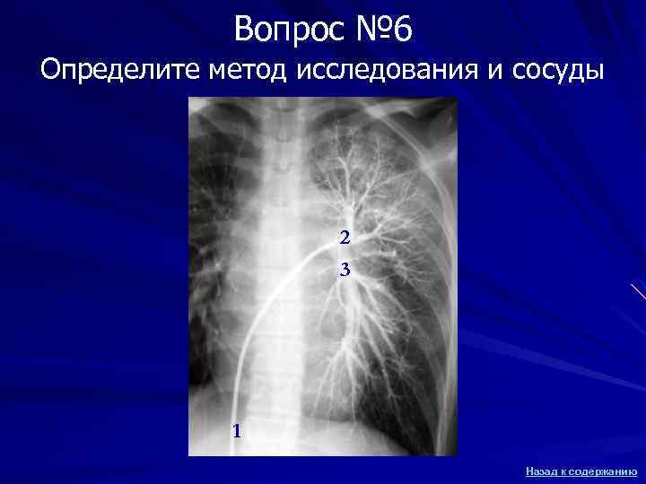 Вопрос № 6 Определите метод исследования и сосуды 2 3 1 Назад к содержанию