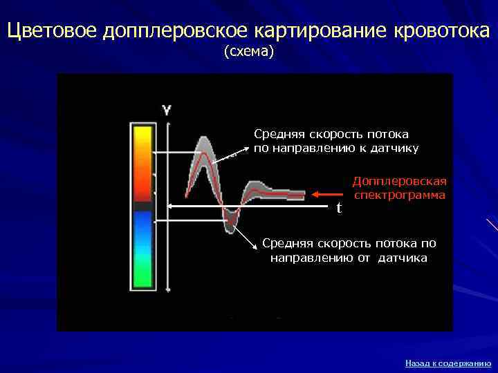 Цветовое допплеровское картирование кровотока (схема) Средняя скорость потока по направлению к датчику t Допплеровская