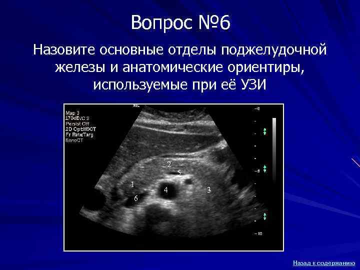 Вопрос № 6 Назовите основные отделы поджелудочной железы и анатомические ориентиры, используемые при её