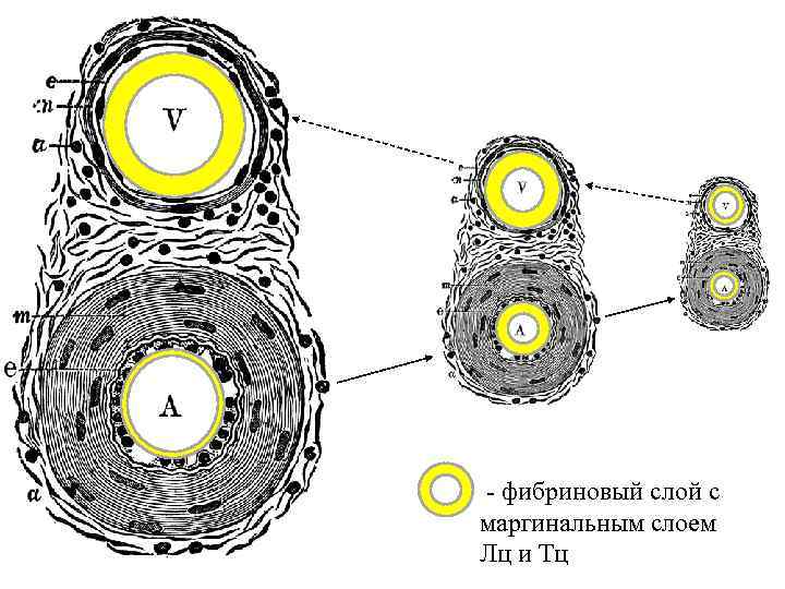  - фибриновый слой с маргинальным слоем Лц и Тц 