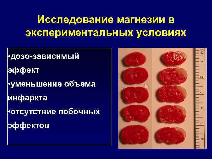 Исследование магнезии в экспериментальных условиях • дозо-зависимый эффект • уменьшение объема инфаркта • отсутствие