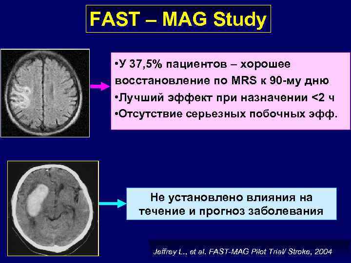 FAST – MAG Study • У 37, 5% пациентов – хорошее восстановление по MRS